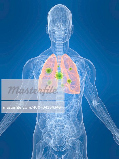 Bacteria In Lungs