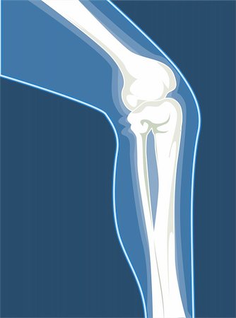 Illustration of human leg bones Stock Photo - Budget Royalty-Free & Subscription, Code: 400-04008700