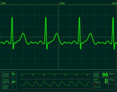simsearch:400-07222508,k - heart monitor screen with normal beat signal Photographie de stock - Aubaine LD & Abonnement, Code: 400-04015201