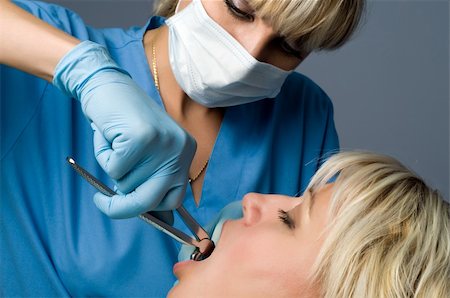 tooth extraction using forceps, special dental instrument for teeth removal Foto de stock - Super Valor sin royalties y Suscripción, Código: 400-04047135