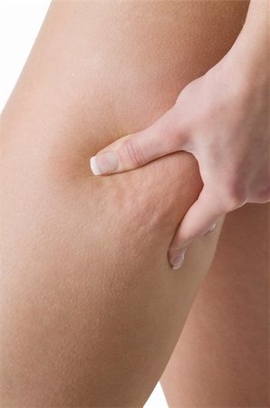 simsearch:400-04180657,k - close up on the leg of a girl showing her cellulite Stock Photo - Budget Royalty-Free & Subscription, Code: 400-04060221