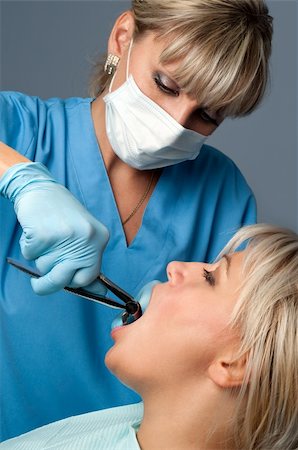 dentist at work, tooth extraction using forceps Stock Photo - Budget Royalty-Free & Subscription, Code: 400-04082927