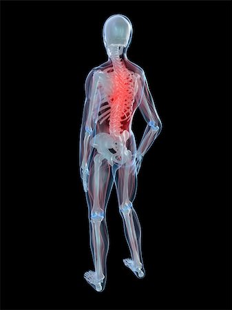 simsearch:400-04900053,k - 3d rendered illustration of a human skeleton with painful back Photographie de stock - Aubaine LD & Abonnement, Code: 400-04103524