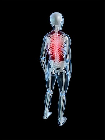 simsearch:400-04900053,k - 3d rendered illustration of a human skeleton with painful back Photographie de stock - Aubaine LD & Abonnement, Code: 400-04103534