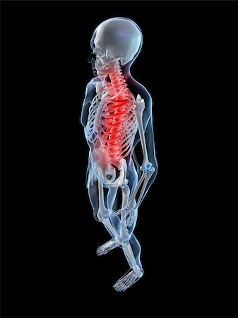 simsearch:400-04900053,k - 3d rendered illustration of a human skeleton with painful back Photographie de stock - Aubaine LD & Abonnement, Code: 400-04103540