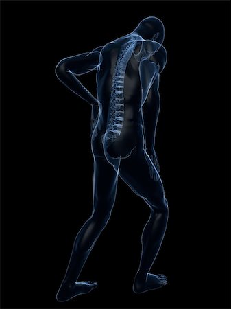 simsearch:400-04900053,k - 3d rendered illustration of a transparent male body with backache Photographie de stock - Aubaine LD & Abonnement, Code: 400-04103541