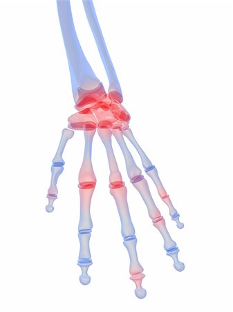 3d rendered x-ray illustration of a skeletal hand with highlighted joints Stock Photo - Budget Royalty-Free & Subscription, Code: 400-04110244