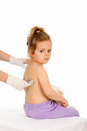 doctor with gloves with child - Little girl with small pox at the doctors examination - isolated healthcare concept Stock Photo - Budget Royalty-Free & Subscription, Code: 400-04136488