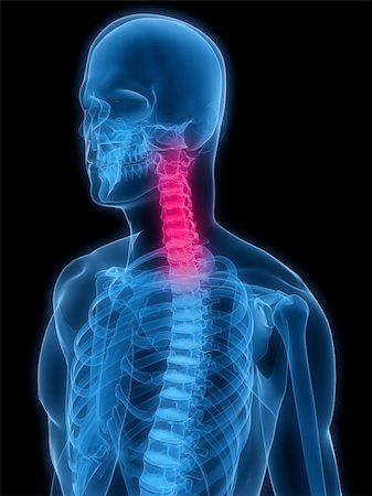 3d rendered x-ray illustration of a human skeleton with highlighted neck Stock Photo - Budget Royalty-Free & Subscription, Code: 400-04154400