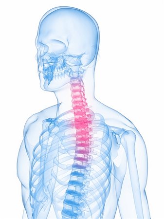 3d rendered x-ray illustration of a human skeleton with highlighted neck Stock Photo - Budget Royalty-Free & Subscription, Code: 400-04154402