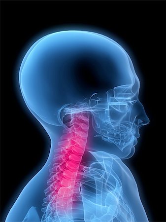 3d rendered x-ray illustration of a human skeleton with highlighted neck Stock Photo - Budget Royalty-Free & Subscription, Code: 400-04154403