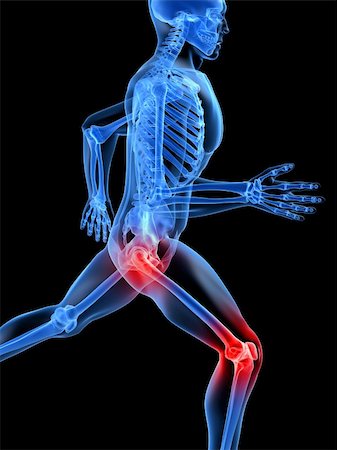 skull xray - 3d rendered x-ray illustration of a transparent running man with painful knees and hips Stock Photo - Budget Royalty-Free & Subscription, Code: 400-04157086