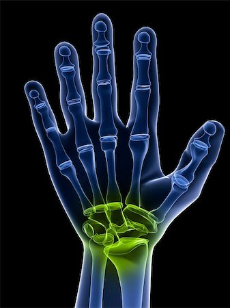 simsearch:400-05753572,k - 3d rendered x-ray illustration of a hand with highlighted joint Stock Photo - Budget Royalty-Free & Subscription, Code: 400-04164423