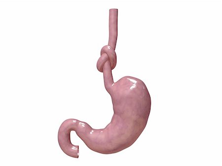 3d rendered illustration of a knot in human stomach Stock Photo - Budget Royalty-Free & Subscription, Code: 400-04169811