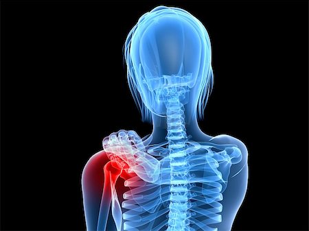 shoulder xray - 3d rendered illustration of a female skeleton with highlighted shoulder Stock Photo - Budget Royalty-Free & Subscription, Code: 400-04191418