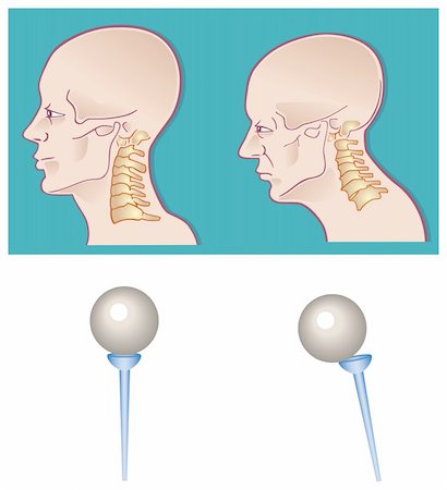 skeleton head drawing - Illustration of neck spine cross section Stock Photo - Budget Royalty-Free & Subscription, Code: 400-04217021