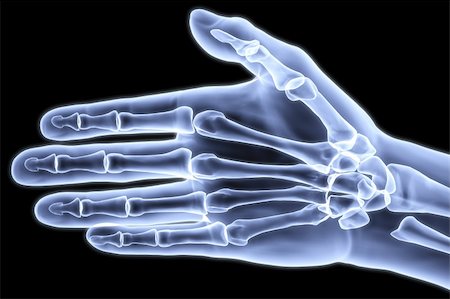 human hand under X-rays. 3d image. Stock Photo - Budget Royalty-Free & Subscription, Code: 400-04272890