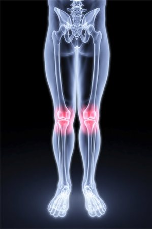 male feet under the X-rays. knee joints are highlighted in red. Stock Photo - Budget Royalty-Free & Subscription, Code: 400-04272916