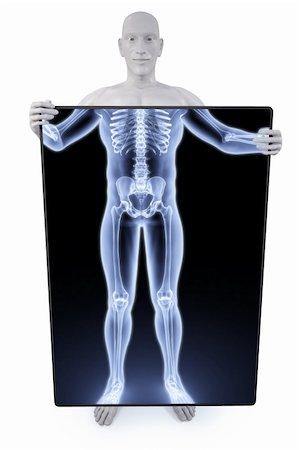 man under the X-rays through the screen. Stock Photo - Budget Royalty-Free & Subscription, Code: 400-04272923