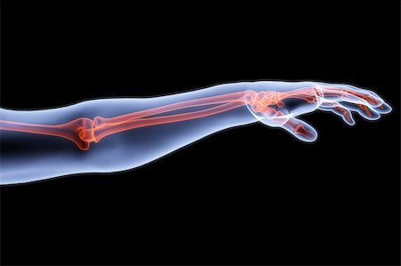 human hand under X-rays. bones are highlighted in red. Stock Photo - Budget Royalty-Free & Subscription, Code: 400-04272946