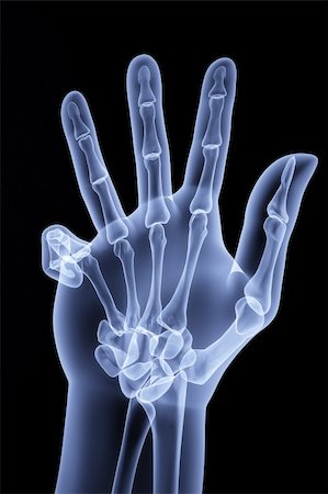 the human hand shows the number of fingers under the X-rays Stock Photo - Budget Royalty-Free & Subscription, Code: 400-04272956