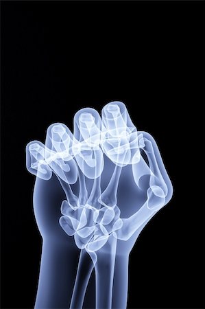 the human hand shows the number of fingers under the X-rays Stock Photo - Budget Royalty-Free & Subscription, Code: 400-04272958