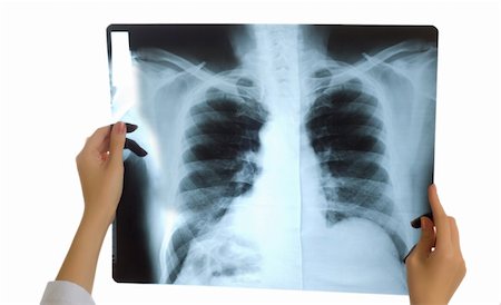 Doctor looking at x-ray image on white Stock Photo - Budget Royalty-Free & Subscription, Code: 400-04345446