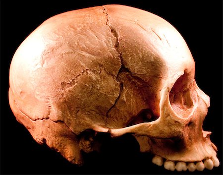simsearch:400-03971352,k - Human skull - bone head dead teeth spooky scary pirate isolated evil Foto de stock - Super Valor sin royalties y Suscripción, Código: 400-04401153