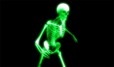 simsearch:400-06394180,k - An x ray image of a Skelton in a pose a suitable image for medical or Halloween based concepts. Stock Photo - Budget Royalty-Free & Subscription, Code: 400-04556078