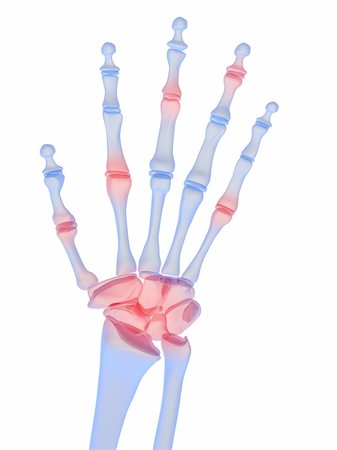 3d rendered x-ray illustration of a skeletal hand with highlighted joints Stock Photo - Budget Royalty-Free & Subscription, Code: 400-04602177