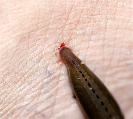 simsearch:400-05338354,k - Leech sucking blood from a leg at tropical rainforest, Malaysia. Stock Photo - Budget Royalty-Free & Subscription, Code: 400-04654531