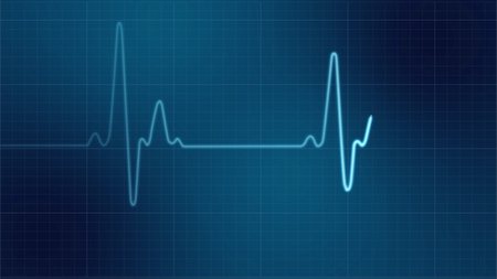 EKG heart monitor Stock Photo - Budget Royalty-Free & Subscription, Code: 400-04679712
