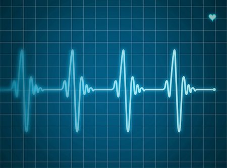 Blue electrocardiogram Stock Photo - Budget Royalty-Free & Subscription, Code: 400-04774519