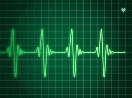 Green electrocardiogram Stock Photo - Budget Royalty-Free & Subscription, Code: 400-04774520