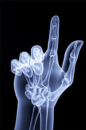the human hand shows the number of fingers under the X-rays Stock Photo - Budget Royalty-Free & Subscription, Code: 400-04784369