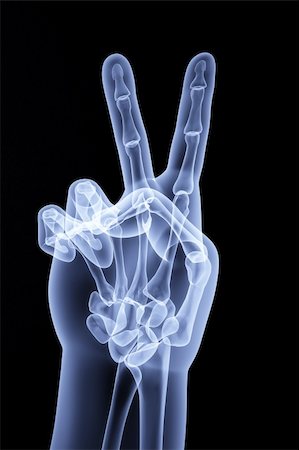 the human hand shows the number of fingers under the X-rays Stock Photo - Budget Royalty-Free & Subscription, Code: 400-04784372
