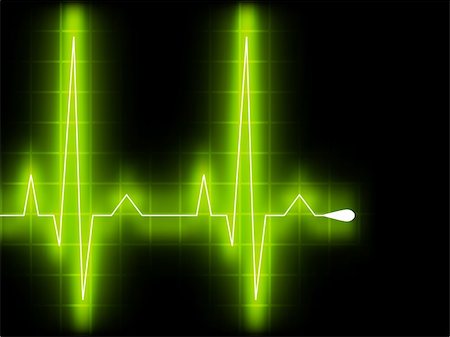 Green heart beat. Ekg graph. EPS 8 vector file included Stock Photo - Budget Royalty-Free & Subscription, Code: 400-04796535