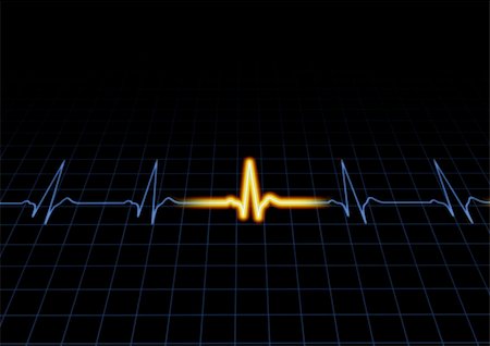 simsearch:400-07222508,k - Illustration of a heart machine display Photographie de stock - Aubaine LD & Abonnement, Code: 400-04842278