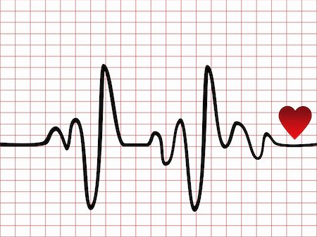 Heart beat monitor or EKG Stock Photo - Budget Royalty-Free & Subscription, Code: 400-04855182