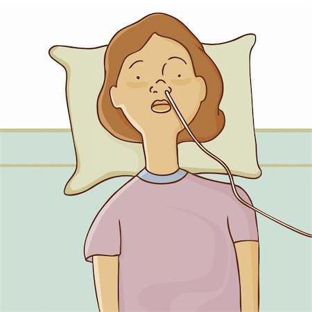 An image of a woman in the hospital with a feeding tube. Stock Photo - Budget Royalty-Free & Subscription, Code: 400-04856894