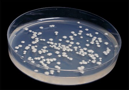 Colonies of microorganisms on microbiological medium with clipping path, on black background. Foto de stock - Super Valor sin royalties y Suscripción, Código: 400-05047731