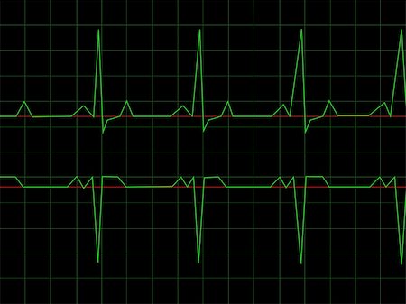 simsearch:400-07222508,k - Normal Heart Rhythm electrocardiogram ECG graph with black background Photographie de stock - Aubaine LD & Abonnement, Code: 400-05138918