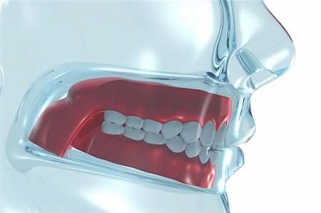 dentures - 3D Rendering of denture. Stock Photo - Budget Royalty-Free & Subscription, Code: 400-05144197