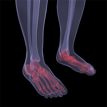 simsearch:400-04900053,k - X-ray of human legs. Render on a black background Photographie de stock - Aubaine LD & Abonnement, Code: 400-06749476