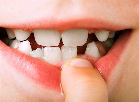 Child shows tooth. Close up studio shot. Stock Photo - Budget Royalty-Free & Subscription, Code: 400-06796581