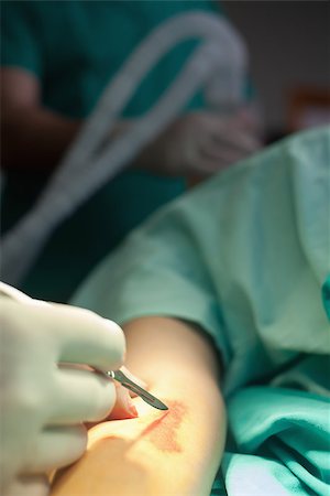 Doctor performing surgery on an arm in a operating theater Stock Photo - Budget Royalty-Free & Subscription, Code: 400-06867973