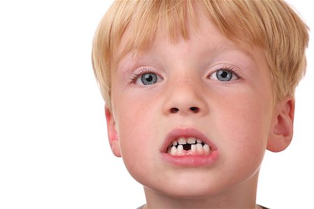 simsearch:400-05153083,k - Closeup of little boy with missing teeth Stock Photo - Budget Royalty-Free & Subscription, Code: 400-07165405