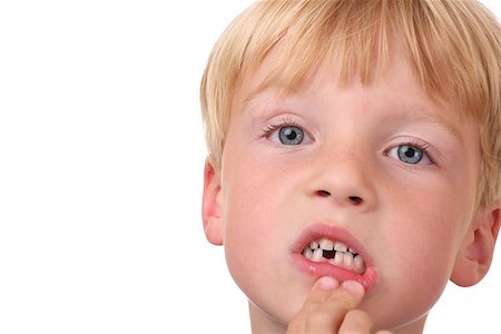 simsearch:400-05153083,k - Closeup of little boy with missing teeth Stock Photo - Budget Royalty-Free & Subscription, Code: 400-07165406