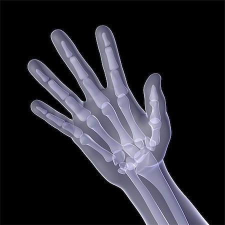 Hand of man. X-ray render on a black background Stock Photo - Budget Royalty-Free & Subscription, Code: 400-07250813