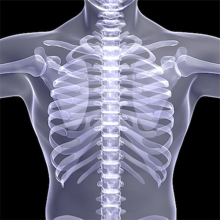 simsearch:400-05753572,k - Thorax person. X-ray render on a black background Stock Photo - Budget Royalty-Free & Subscription, Code: 400-07250828